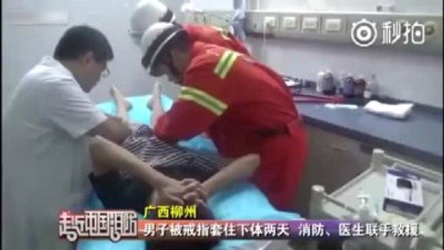 Cinsel Organına Taktığı Yüzüğü Çıkartamayınca Hastanelik Oldu