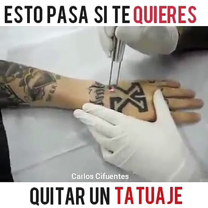 tatuje borrado