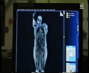 Resonancia Magnetica: Grasa corporal