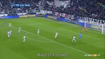 Jose Callejon  Goal HD - Juventust1-1tNapoli 29.10.2016