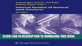 [PDF] Internal fixation of femoral neck fractures: An Atlas Full Online