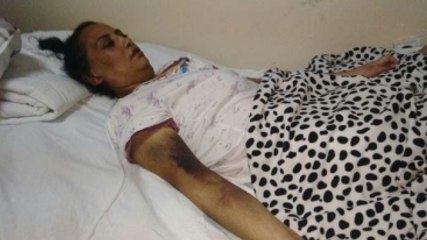 Sakarya'da Mide Küçültme Ameliyatı Oldu, Şimdi Yaşam Mücadelesi Veriyor