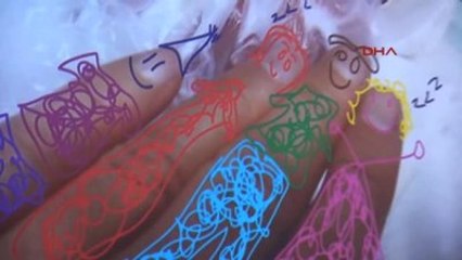 Eskişehir - 380 Gramlık Azra Bebek Yaşama Tutundu