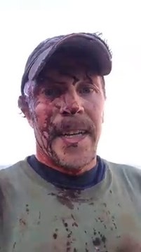 Un chasseur se filme après avoir été attaqué par un ours