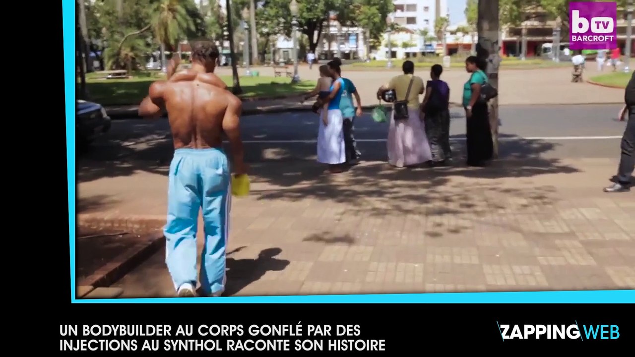 Un bodybuilder au corps gonflé par des injections au Synthol raconte son histoire (vidéo)