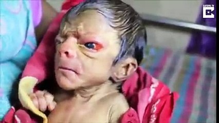 HİNDİSTAN DA DOĞAN İLGİNÇ BEBEK!!!