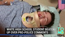 Hate crime? White high school student assaulted over possible pro-police comments - TomoNews