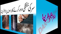 Dandruff Treatment in urdu | Sar Ki Khushki Door Karne Ka ilaj in Urdu |Hair Dandruff Remove in urdu