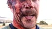 Hiker Survives Two Grizzly Bear Attacks