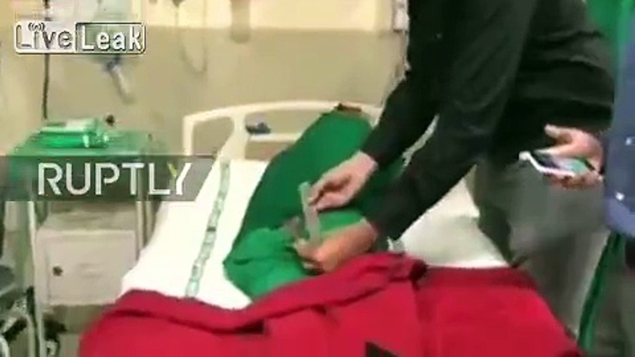 Ce jeune indien se fait retirer une queue de 18 cm qui lui a poussé dans le dos