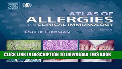 [PDF] Atlas of Allergies and Clinical Immunology: Textbook with CD-ROM Popular Colection
