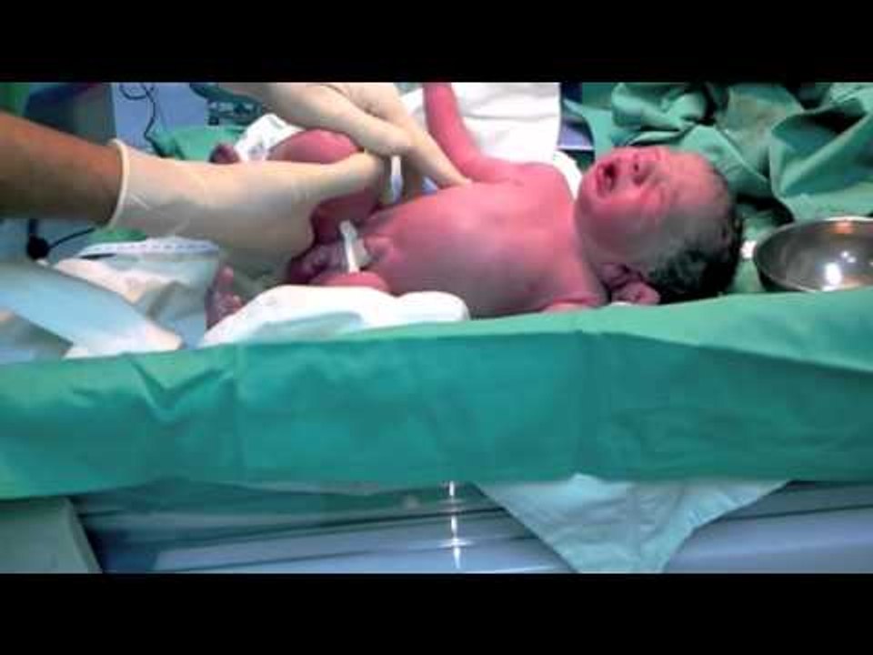 Prueba de Apgar