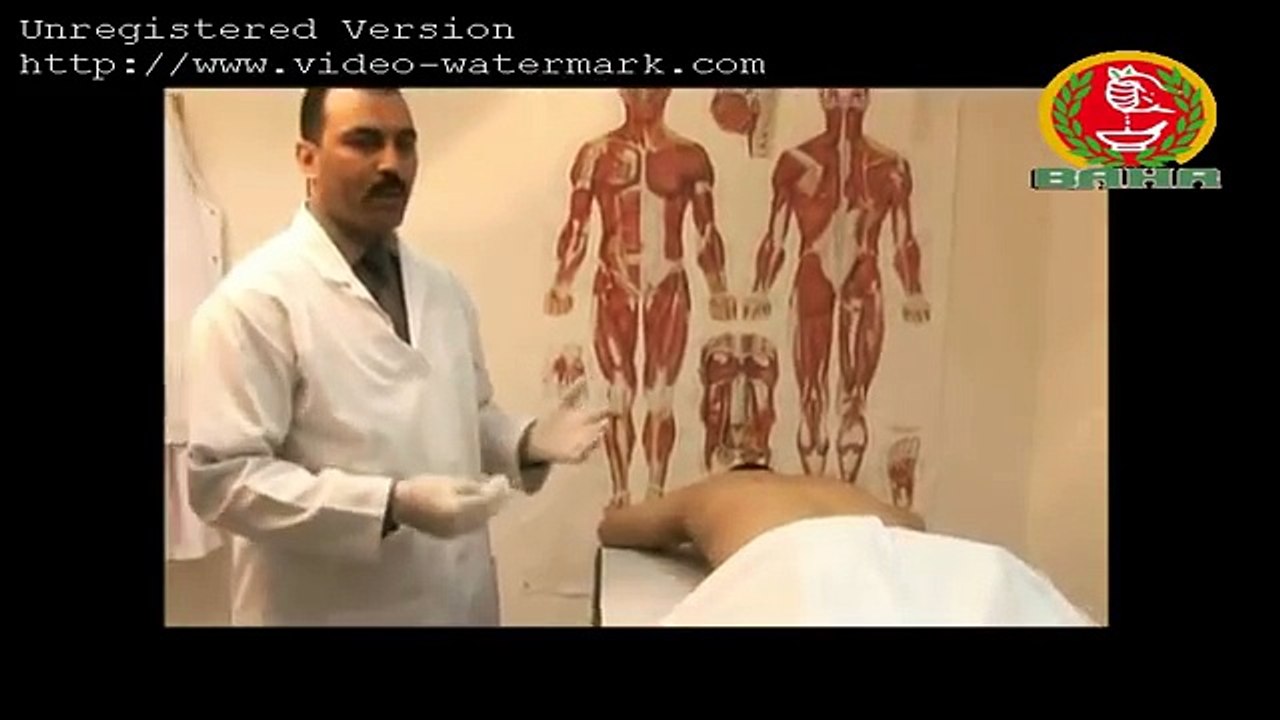 فوائد الحجامة