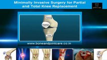 Minimally Invasive Knee Replacement Surgery - By Dr Shailendra Patil