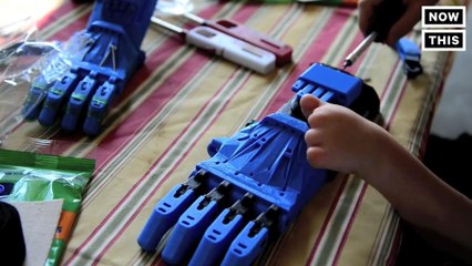 Company Makes Free Prosthetics For Kids