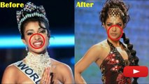 Bollywood Actresses And Their Plastic Surgeries! Before and After 2016