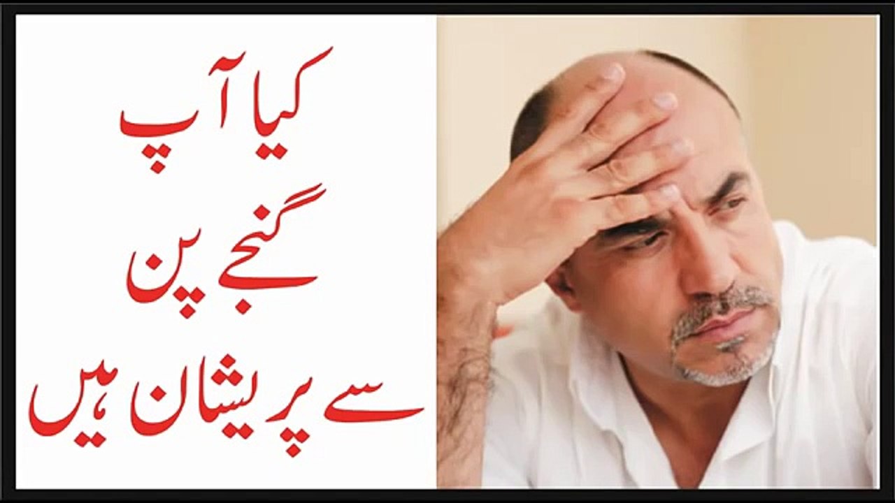Ganje Pan Ka Ilaaj  balon ka girna band hair fall treatment بال گھنے کرنے کا طریقہ