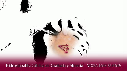 Hidroxiapatita Cálcica en Granada y Almería