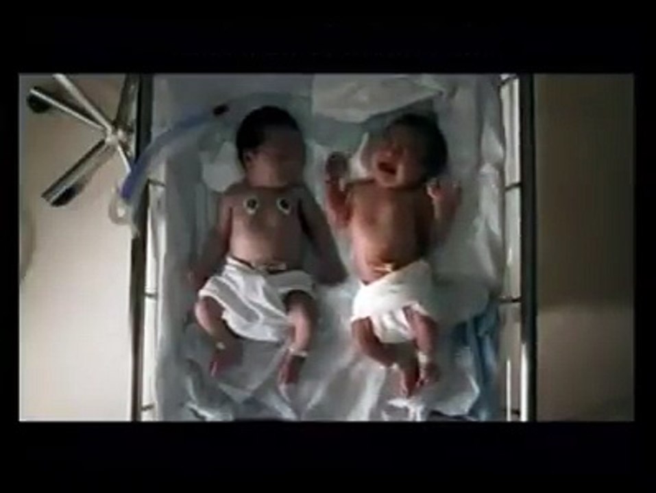 Anne şefkatinin yapabildiklerine müthiş bir örnek. they do a terrific example of motherly compassion.ils font un excelle