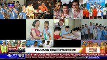 Female Zone: Pejuang Down Syndrom #1