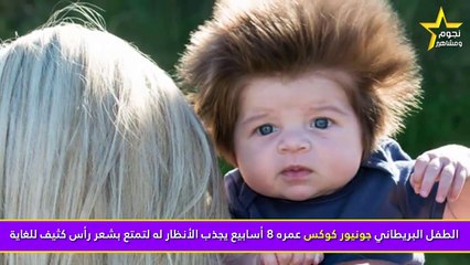 الطفل المعجزة.. عمره شهرين ويتمتع بكثافة شعر لا تصدق!