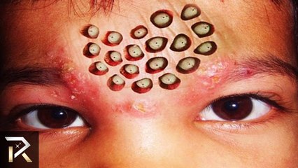 10 Unusual Phobias Discovered In People