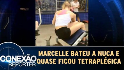 Marcelle bateu a nuca e quase ficou tetraplégica
