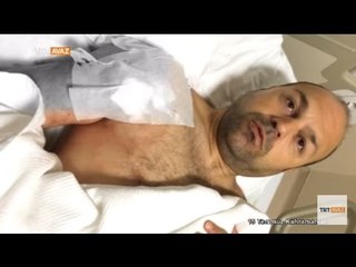 Kendi Askerlerim Tarafından Vurulmam Çok Ağrıma Gitti - 15 Temmuz Kahramanları - TRT Avaz