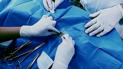 Here is the incredible examination taken by the Japanese surgeons