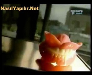 Protez Diş Nasıl Yapılır?