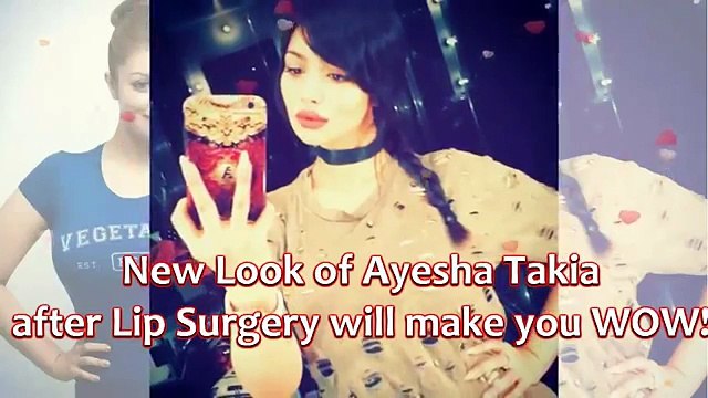OMG, New Look of Ayesha Takia after Lip Surgery will make you WOW!