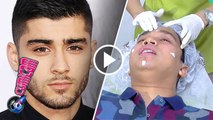 Biar Mirip Zayn Malik, Billy Syahputra Rutin Poles Wajah - Cumicam 13 Oktober 2016