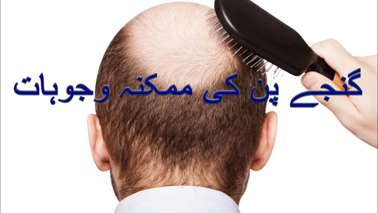 Causes of baldness for men and women in urdu and hindi