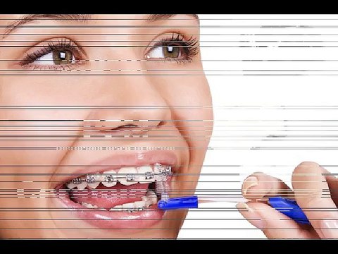 Sierra Springs Dental - Airdrie Dentists, Dental Care in Airdrie