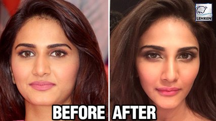 Will Vaani Kapoor's LIP Surgery For 'Befikre' Help Her?
