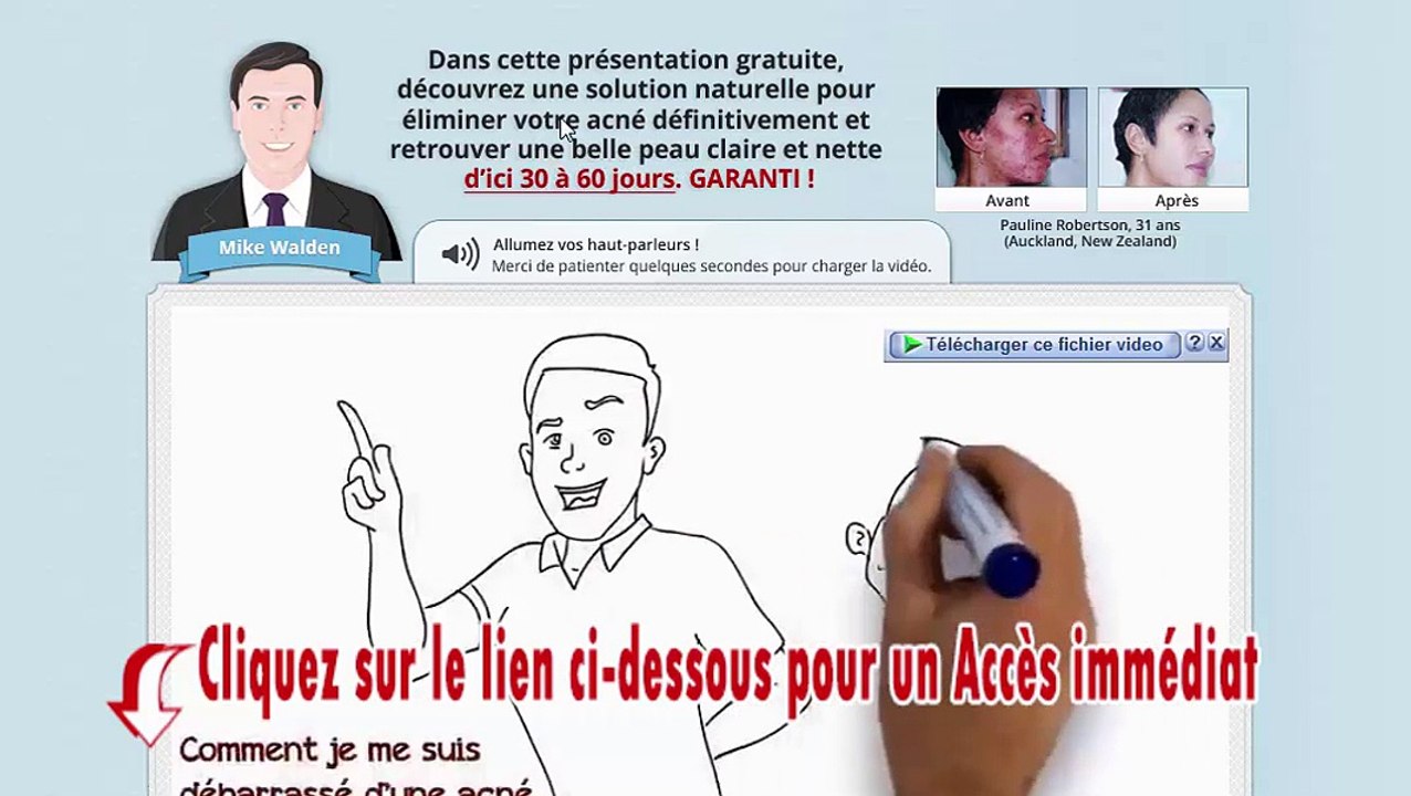 Acné dans le dos