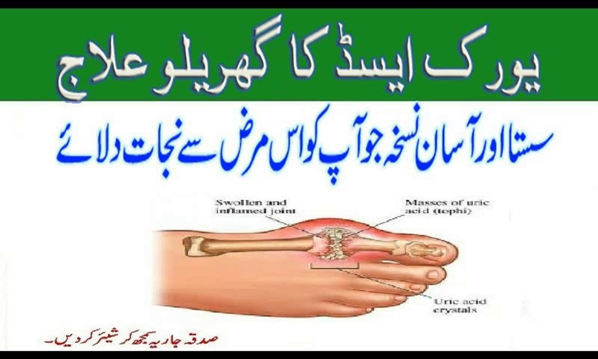 Uric Acid ka ilaj, Uric Acid Treatment at home