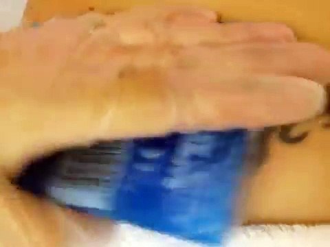 Laser Tattoo Removal - Pemex Energy Gurgaon