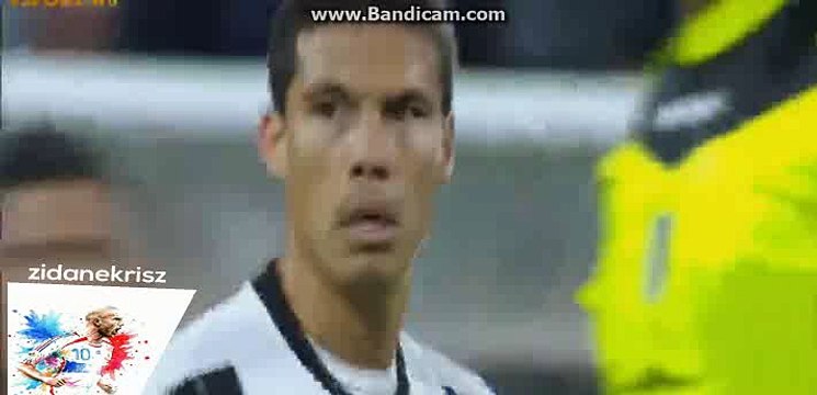 Juventus Fantastic Chance - Juventus vs Udinese - Serie A - 15/10/2016