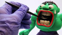 HULK Goes to the Dentist _ Play Doh Superhero Stop-motion with Batman