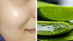 How to get clear, glowing, spotless skin by using aloe Vera gel