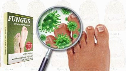 The Fungus Terminator System Detailed Review