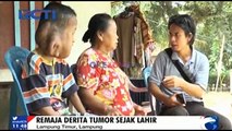 Tidak Punya Dana, 15 Tahun Derita Tumor Hanya Berobat Alternatif
