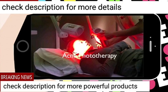 Acne treatment | revitol acne removal cream | acne removal