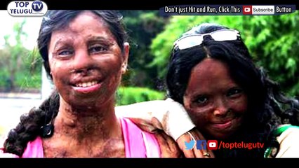 Acid-Attack Survivor Reshma Qureshi RAMP WALK | New York Fashion Week | #TopTeluguTv