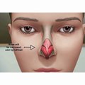 Amazing Nose Oprate Must Watch Like & Share