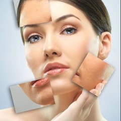 Adeus Acne