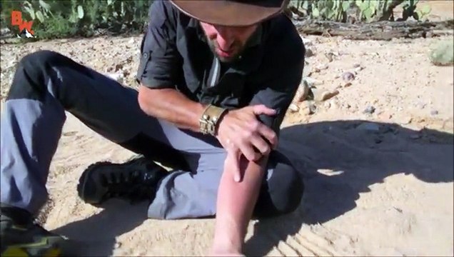 Il se laisse piquer par une guêpe au venin terriblement puissant : Guêpe Pepsis