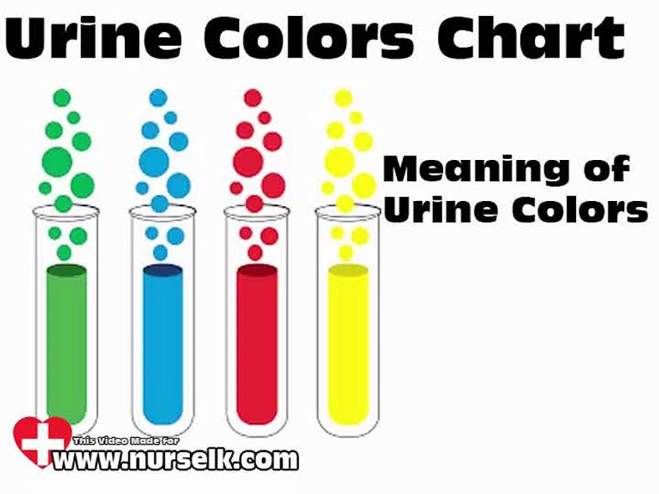 Urine Colors Chart Meaning of Urine Color