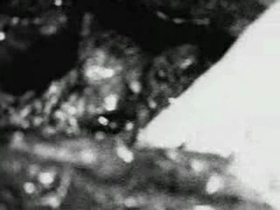 Autopsie De Roswell